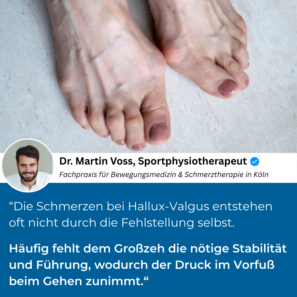 HESTALY™ - Hallux-Valgus