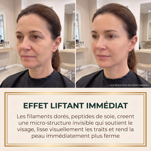 Effet liftant immédiat, résultats visibles