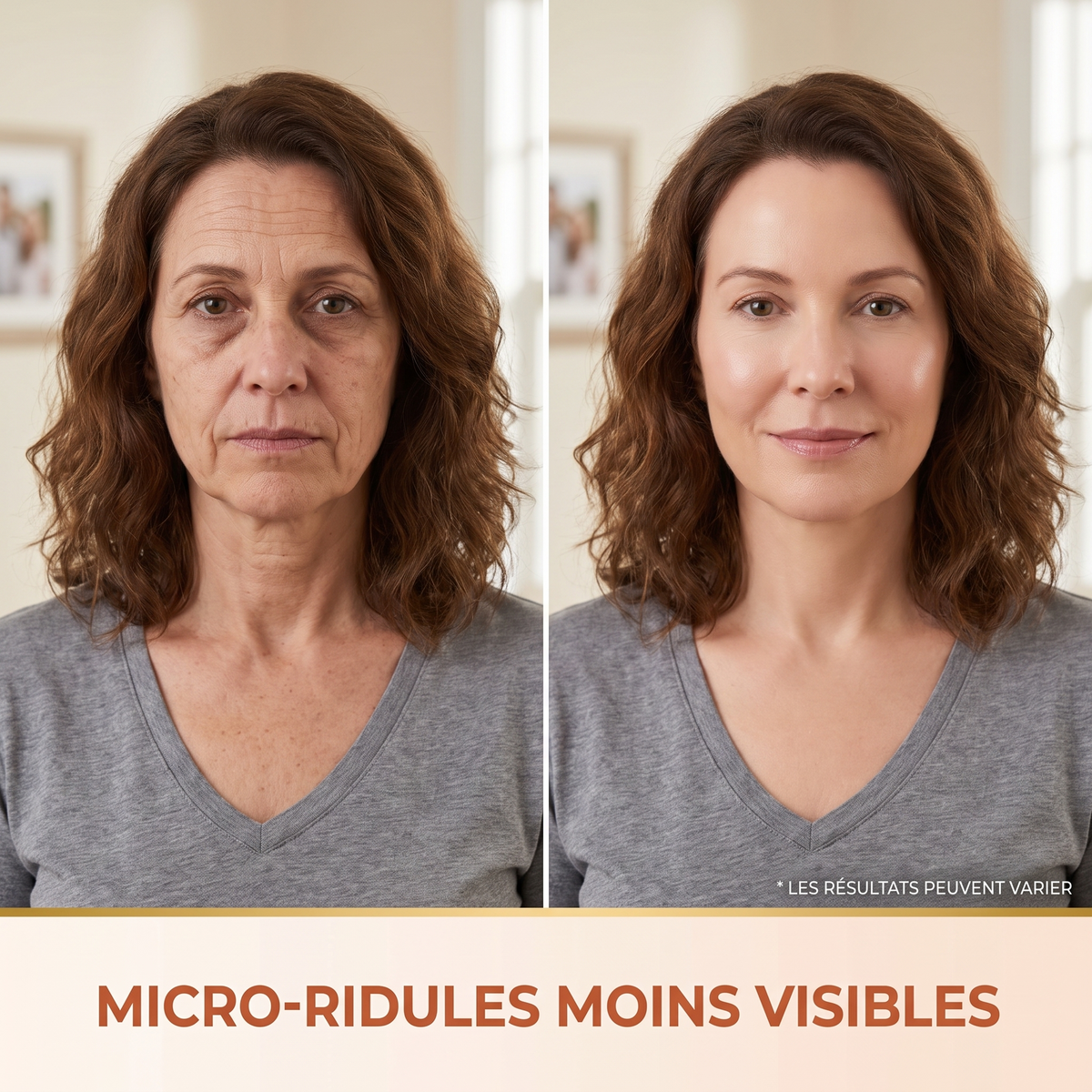 serum 04 microridules