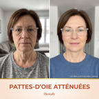 serum 08 pattes oie