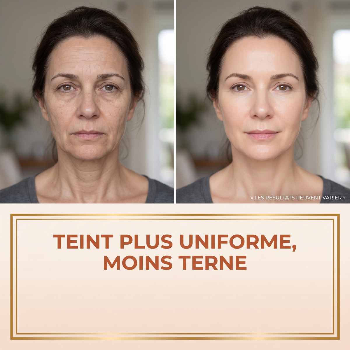 serum 12 teint uniforme